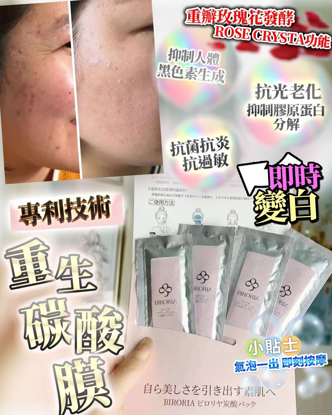 $190盒4入。2盒起$180盒。日本重生碳酸面膜 (1盒4次)