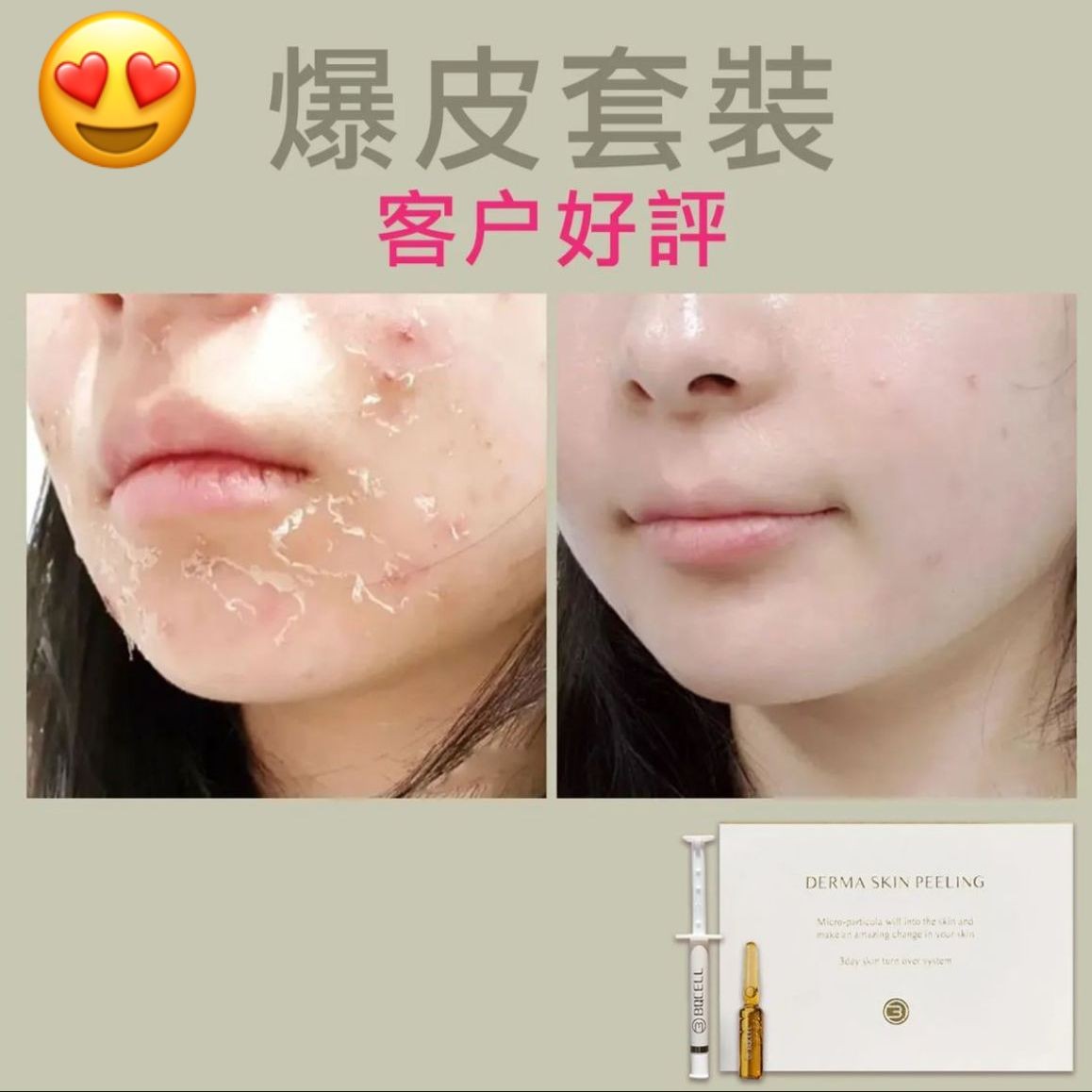 $32O套。5月中到WFH必備，72小時.皮膚重新勁到爆
