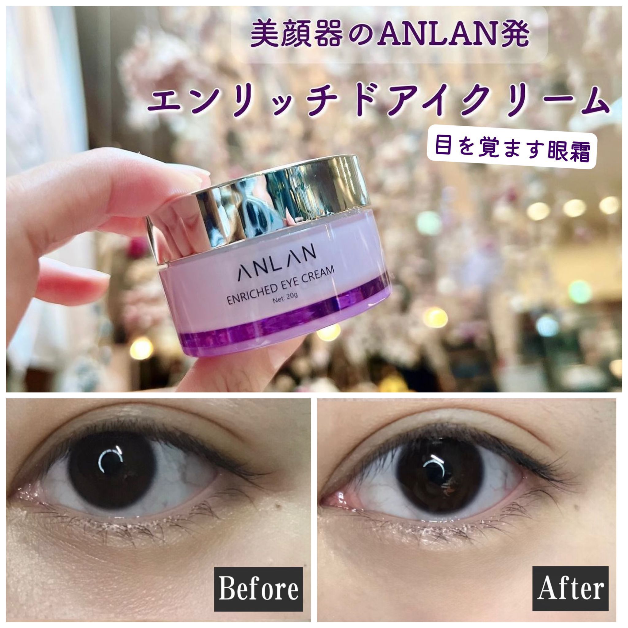$198/1。2件起$188/1。ANLAN 喚醒浓缩眼霜 20g同Esteelauder 同厂. 专柜质量*