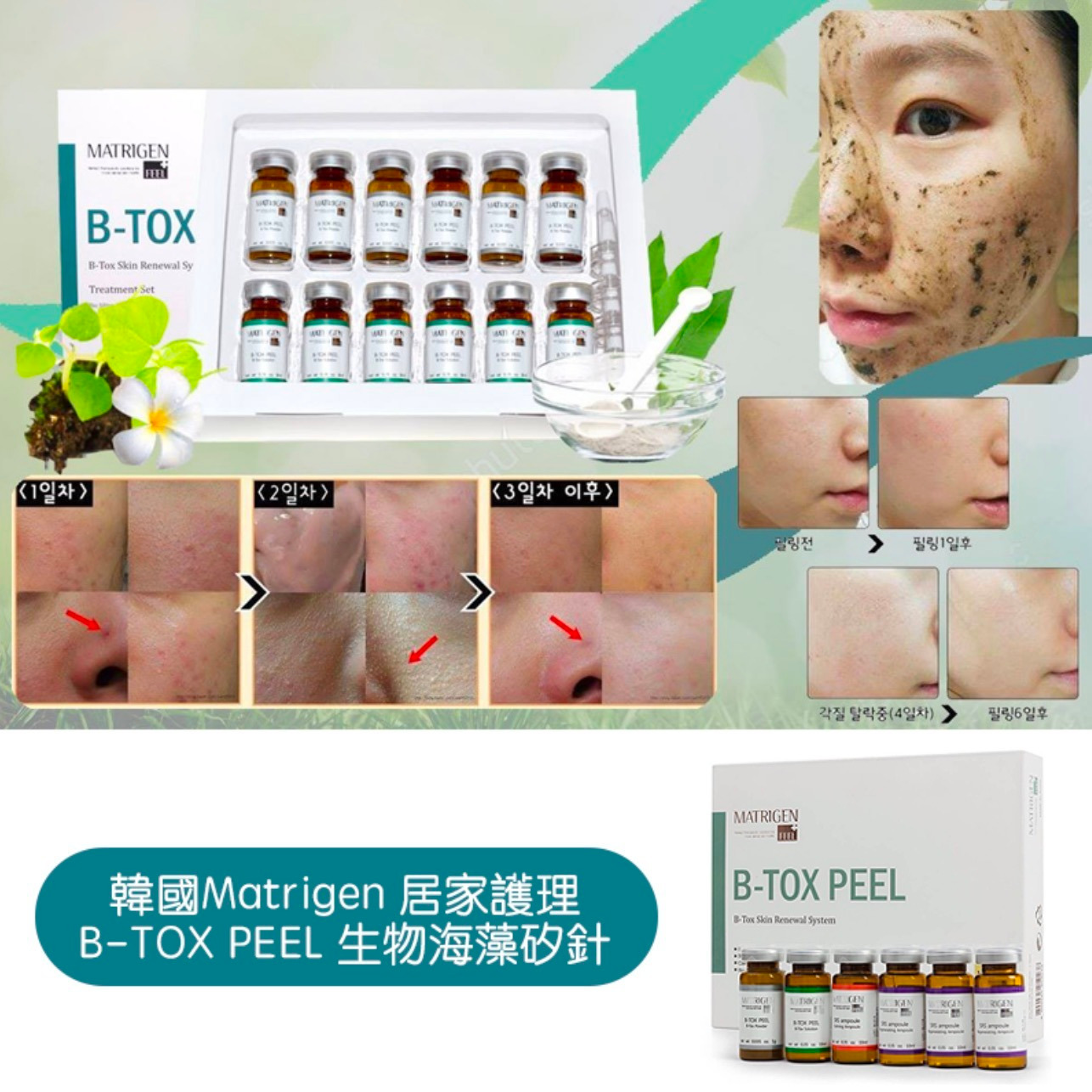 $188套。2套起$180套。韓國制 Matrigen B-Tox Peel 海藻矽針皮膚再生修復療程。