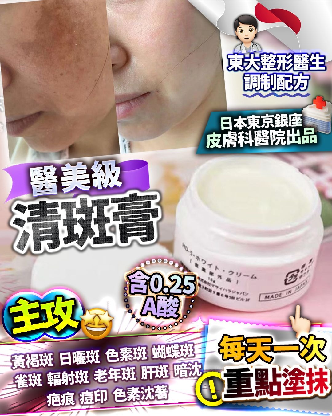 $168件。2件起$158件。日本清斑膏 15g 重點塗抹