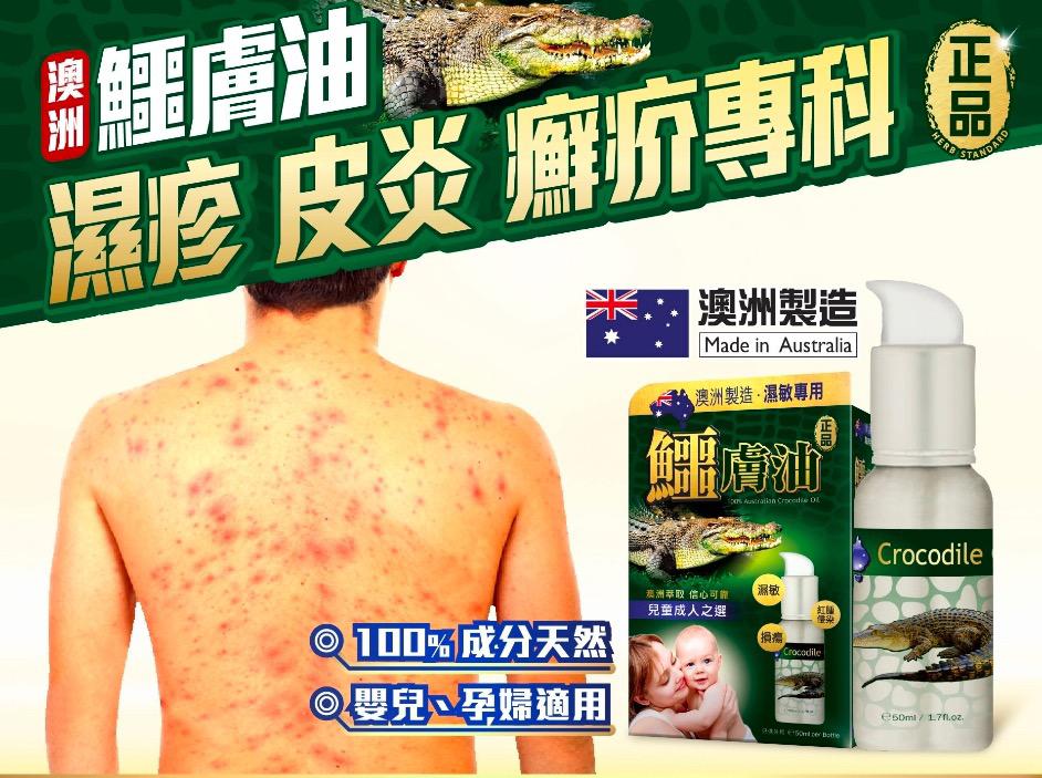$238樽。2樽起$230樽。Herb Standard正品藥業-鱷膚油 50ml