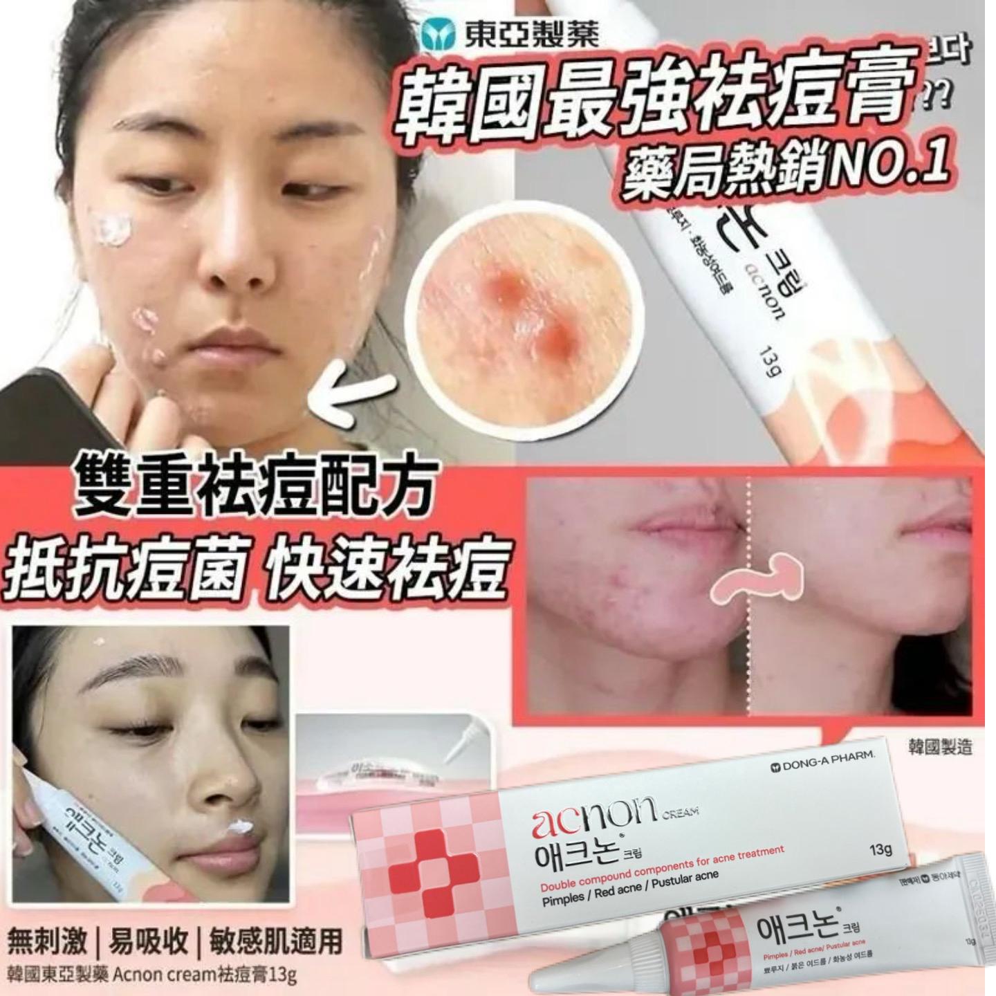 $132支。2支起$122支。🇰🇷 No scar 超強修復淡疤膏 去疤膏 除疤修復膏 韓國東亞 知名除疤軟膏