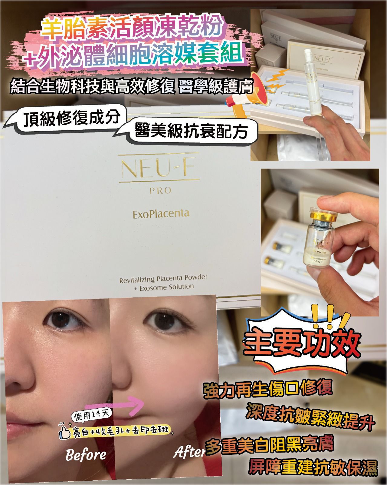 NEU F PRO ExoPlacenta營養針 $320盒。