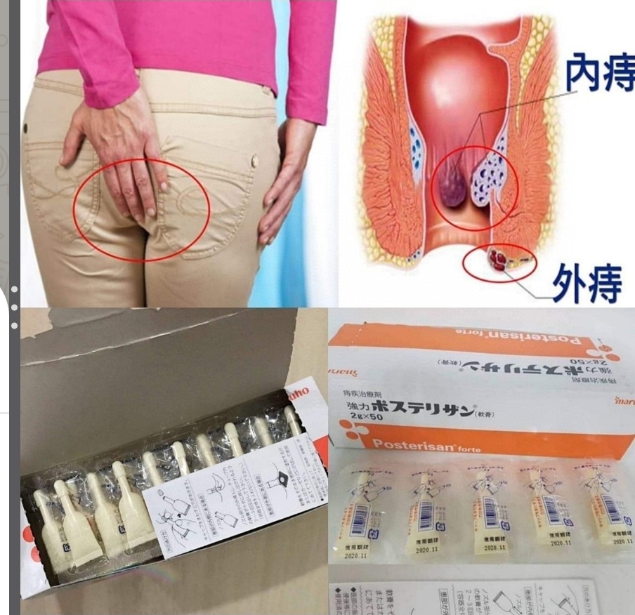 $55排5支。2排起$45排。日本👨🔬醫生推薦的痔瘡膏