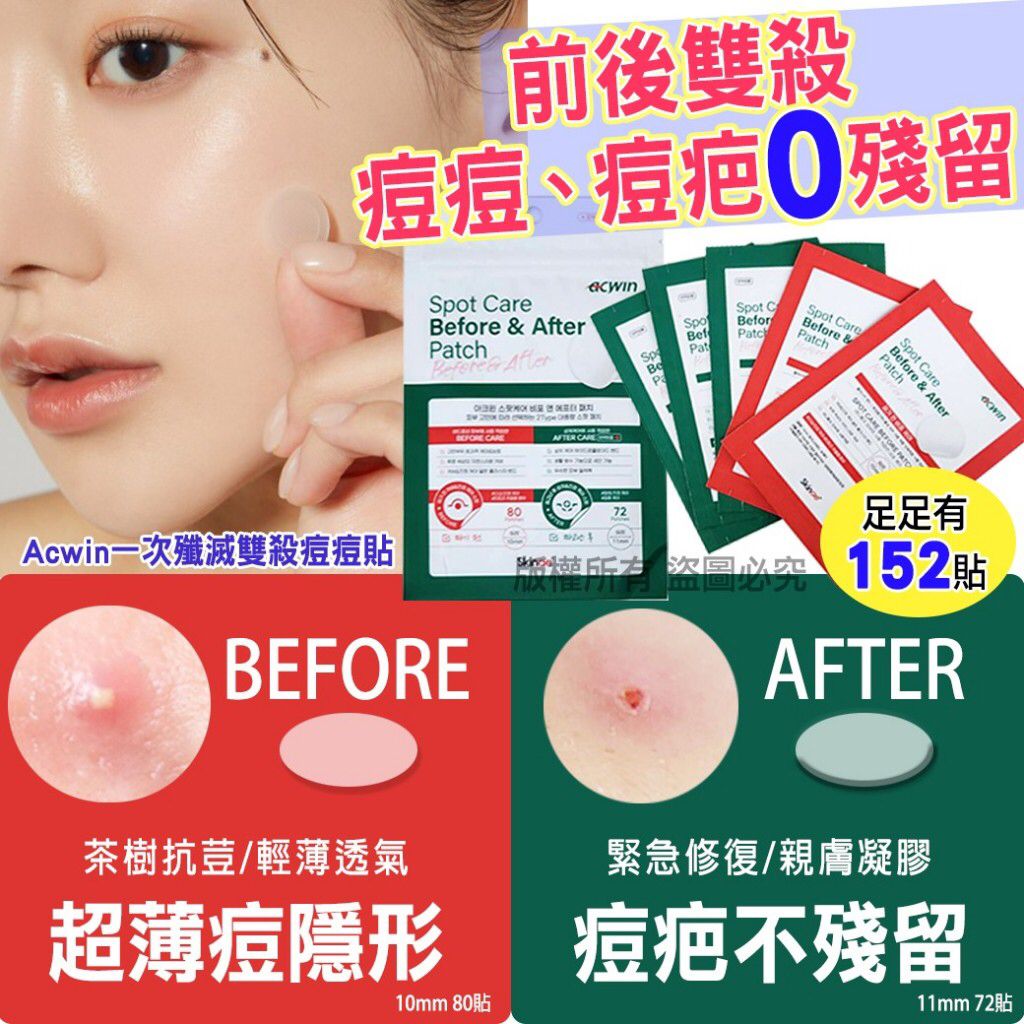 $52盒152贴。2盒起$45盒。韩国制造 Acwin 一次殲灭双殺痘痘贴152贴