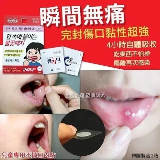韩国制造瞬间不痛不掉口内贴-1套3盒$55/套2套起$48/套