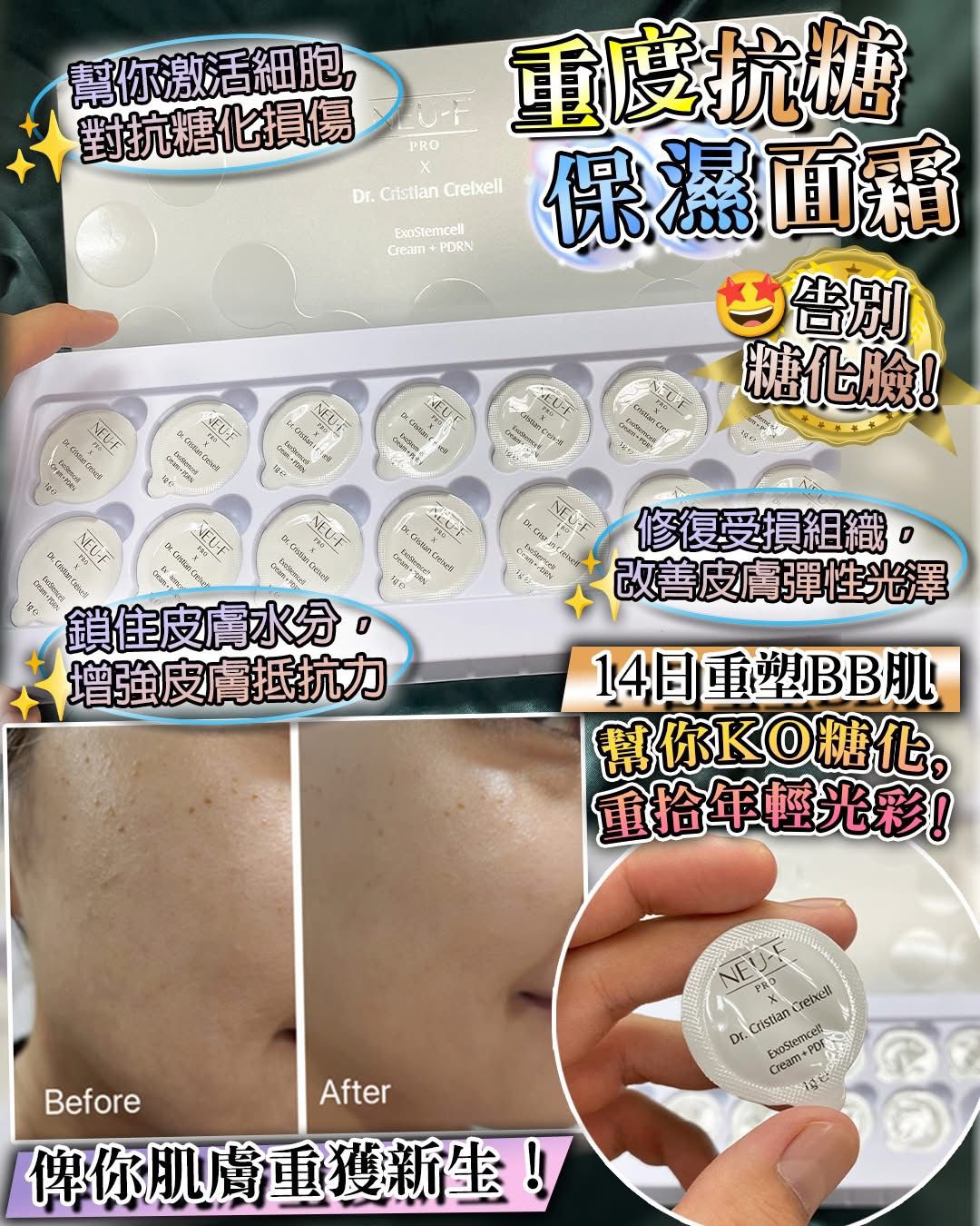 $330盒。2盒起$ 320盒。Neu-F ExoStemcell + PDRN Cream 強效抗糖保濕面霜 14 pcs