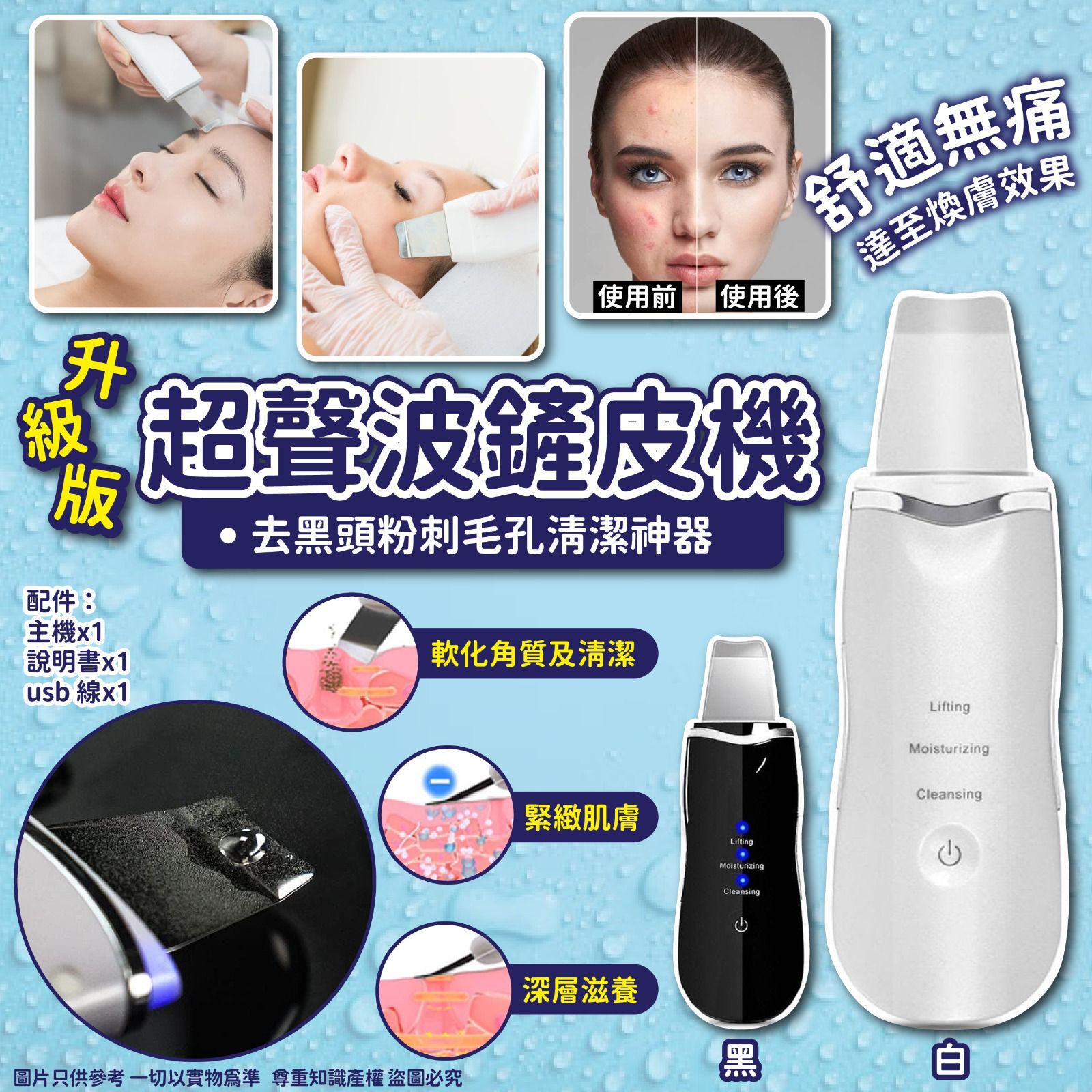 $88/1。升级版超声波铲皮机去黑头粉刺仪毛孔清洁神器 Ultrasonic Skin Scrubber